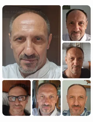4 - Trans Roma - 3913904535
